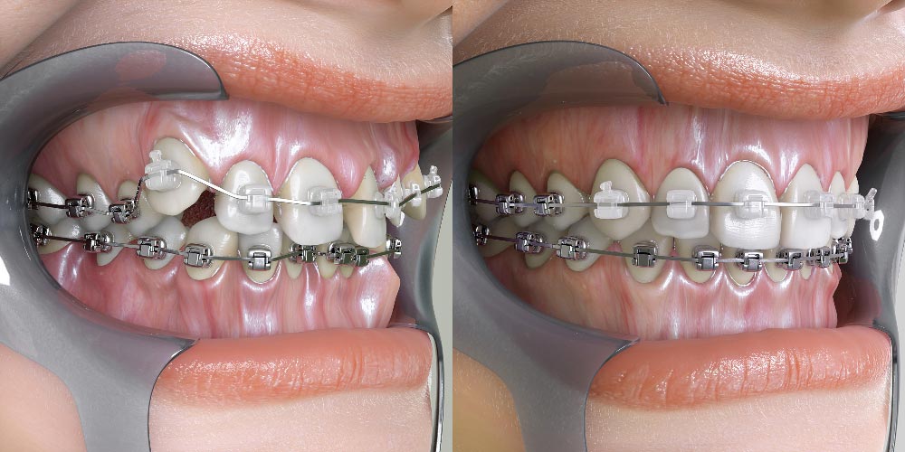 studio-dentistico-chiazzolla-113
