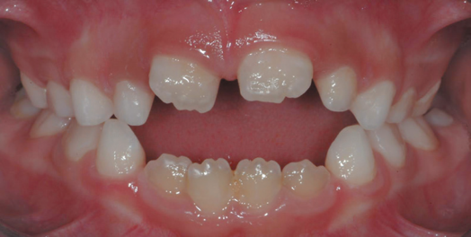 studio-dentistico-chiazzolla-114