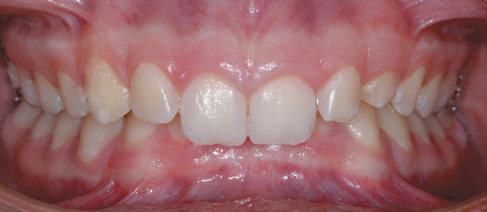 studio-dentistico-chiazzolla-115