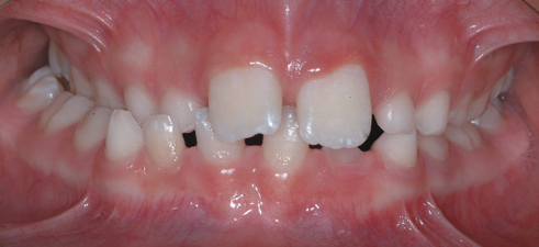 studio-dentistico-chiazzolla-116