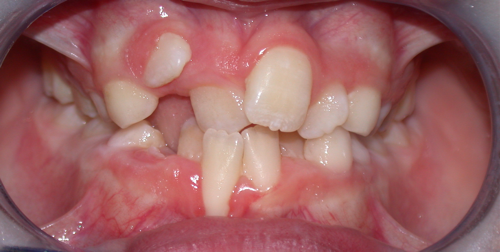 studio-dentistico-chiazzolla-117
