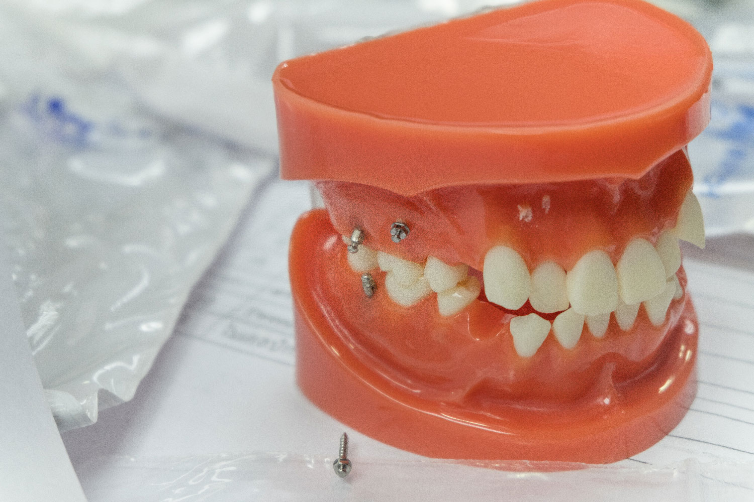 dentista-chiazzolla-20