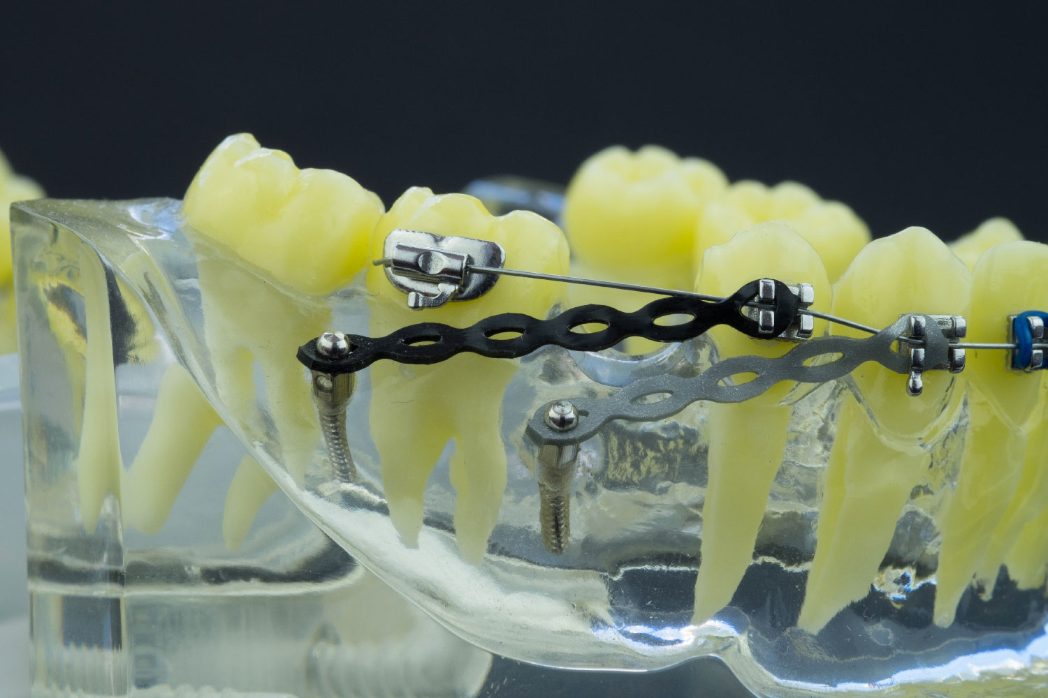 dentista-chiazzolla-21